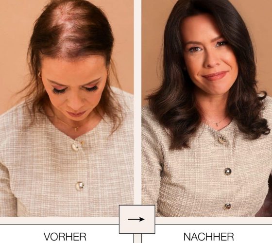 Hairdreams Vorher-Nachher